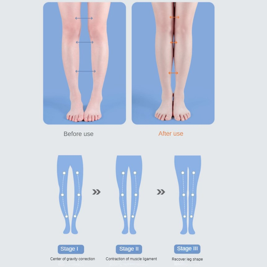 PU Orthotic 깔창 아치 지원 신발 용 플랫 발 - Women Shoes Types 리뷰 및 가격